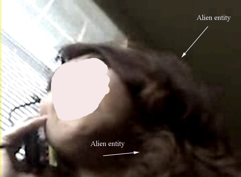 Alien entities in head area