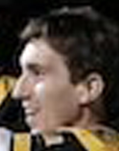 Jeff Bauman Bruins game left ear  