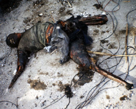 whitGaza white phosphorous victim 2