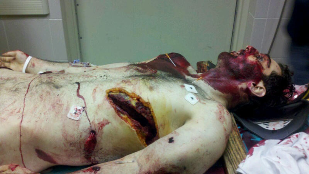 Tamerlan Tsarnaev's dead body photographed at hospital