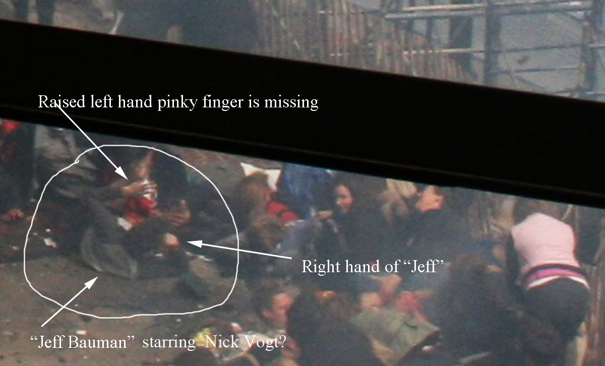 Raised left hand of "Jeff Bauman" shows missing pinky finger