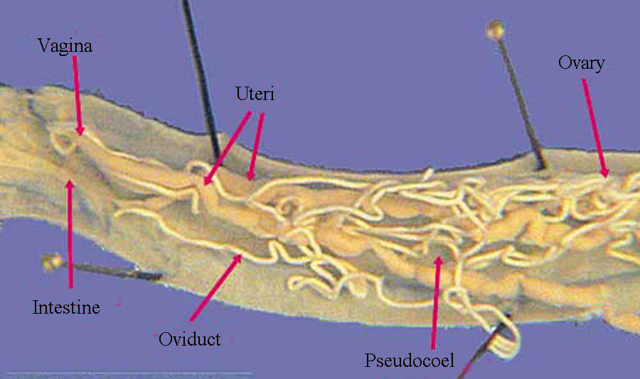 ascaris intestines